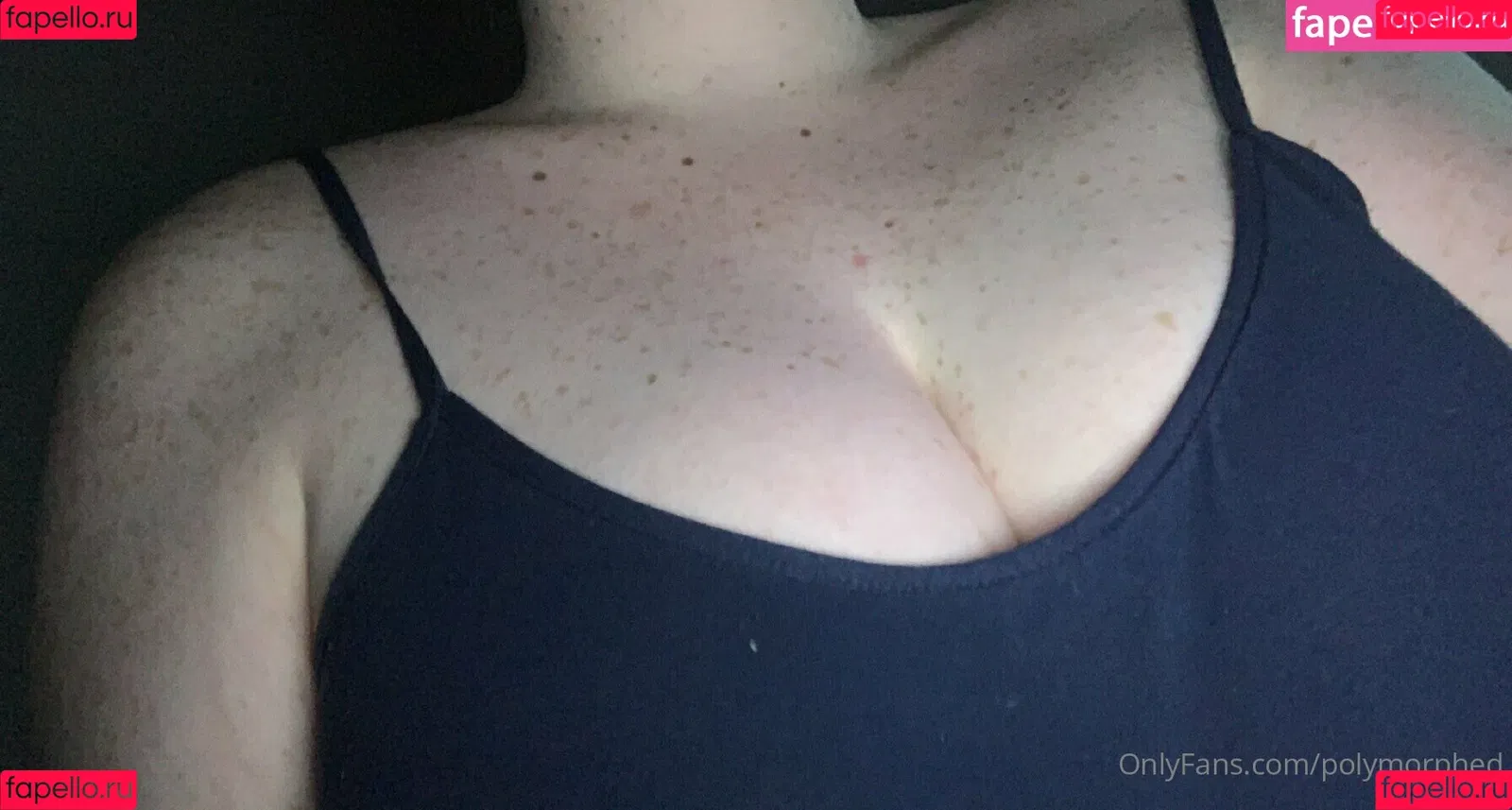 Polymorphed Onlyfans Photo Gallery 